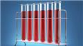 Blood Biochemistry