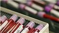 Blood Testing - CBC