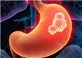 Eosinophilic Gastrointestinal Disease