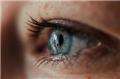 Keratoconus