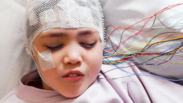 Epilepsy