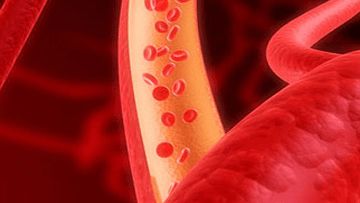 Fanconi's Anemia