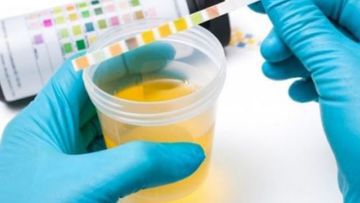 Hematuria (Blood in Urine)