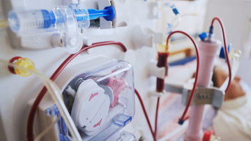Kidney Dialysis
