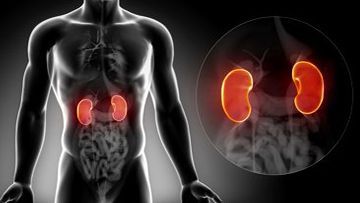 Kidney Transplantation