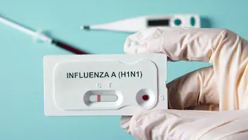 Novel Influenza A (H1N1) Laboratory Testing