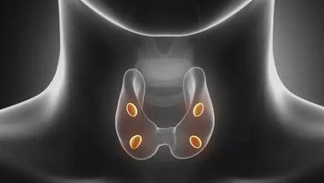 Primary Hyperparathyroidism - Blood Picture