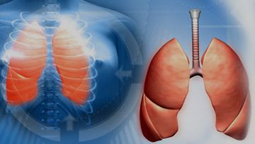 Tuberculosis
