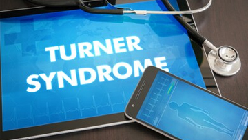 Turners Syndrome