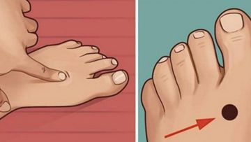 Acupressure and Acupuncture