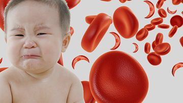 Iron Deficiency in Children