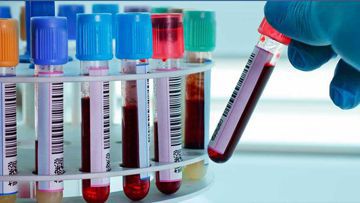 Blood Biochemistry