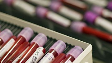 Blood Testing - CBC