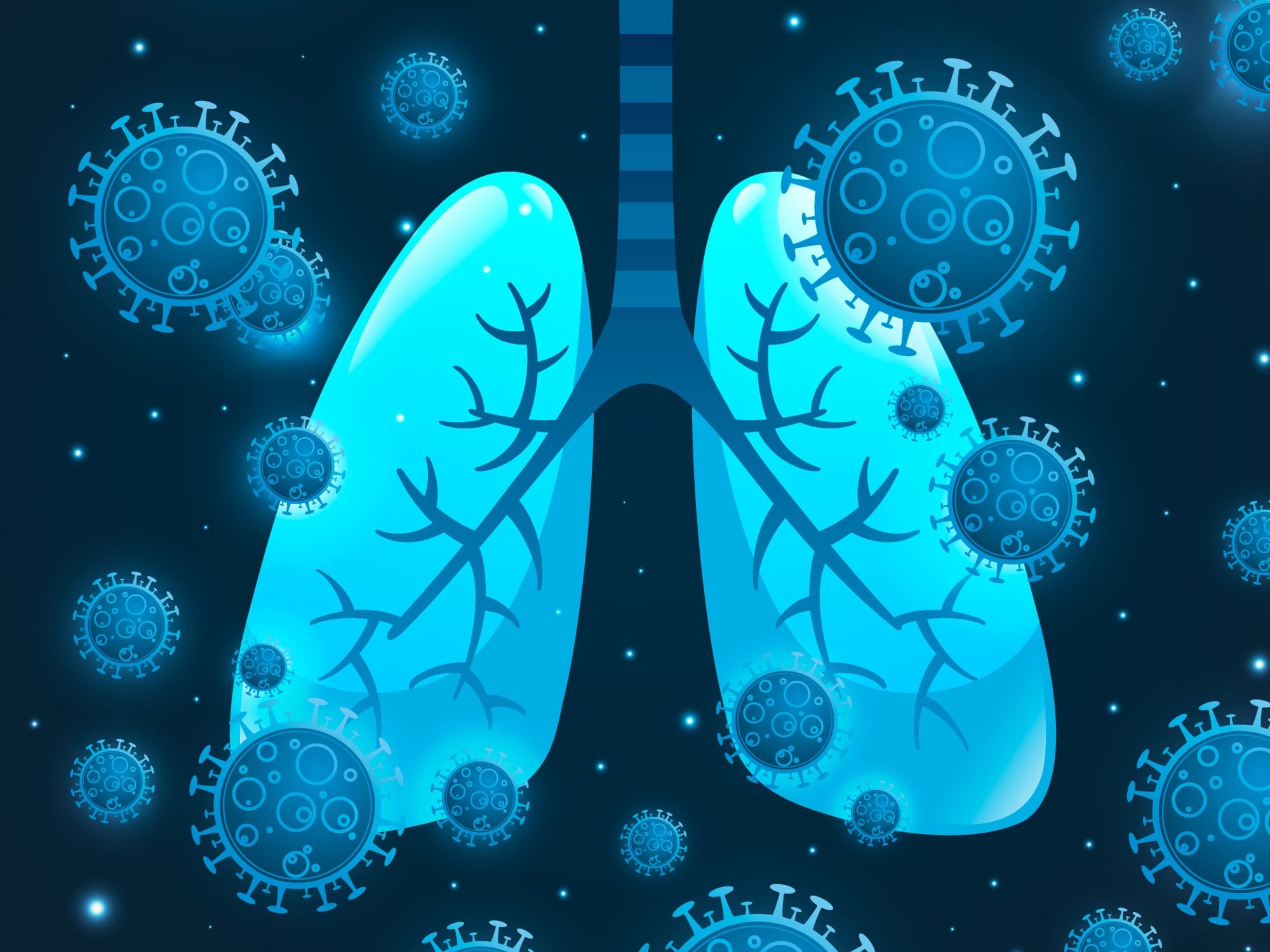 Beyond the Bubble: Surfactant therapy Ineffective for Ventilated Infants with RSV
