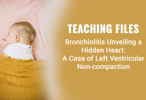 Bronchiolitis Unveiling a Hidden Heart: A Case of Left Ventricular Non-compaction
