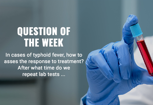 In cases of typhoid fever, how to asses the response to treatment? After what time do we repeat lab tests and what indicates a good response and cure in it? And if no cure, do we repeat the same treatment?