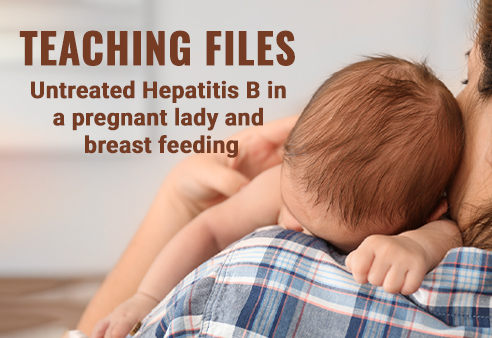 Untreated Hepatitis B in a pregnant lady and breast feeding