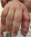 Spot Diagnosis
