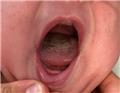 Spot Diagnosis