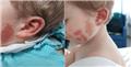 Spot Diagnosis