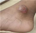 Spot Diagnosis