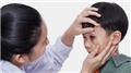 Eye Injuries