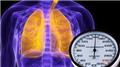 Pulmonary Hypertension