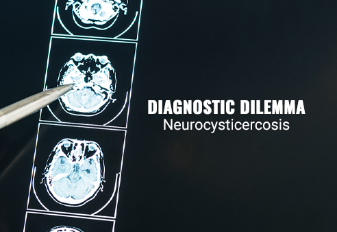 Neurocysticercosis