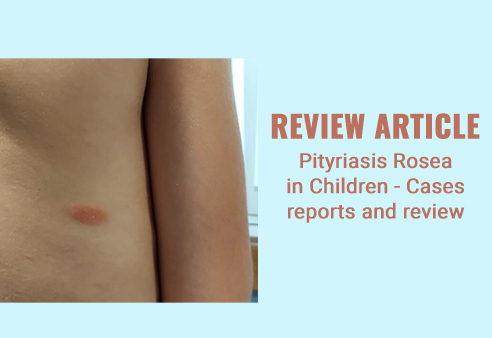 Pityriasis Rosea in Children - Cases reports and review